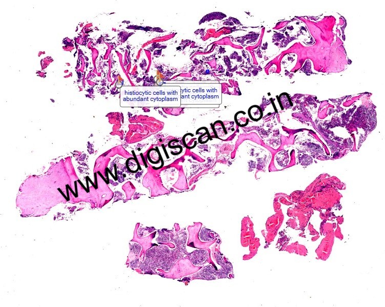 Hematology Digital Slides Set (Peripheral Blood Smear & Bone Marrow Slides)
